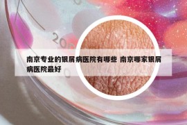南京专业的银屑病医院有哪些 南京哪家银屑病医院最好
