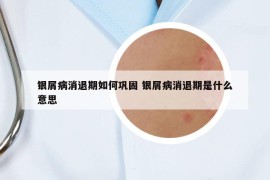 银屑病消退期如何巩固 银屑病消退期是什么意思