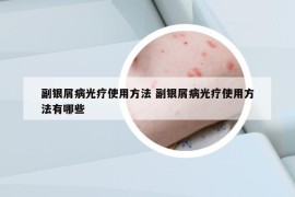 副银屑病光疗使用方法 副银屑病光疗使用方法有哪些