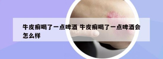 牛皮癣喝了一点啤酒 牛皮癣喝了一点啤酒会怎么样