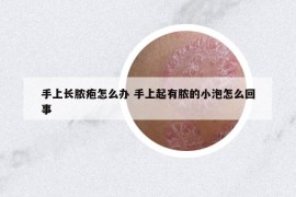 手上长脓疱怎么办 手上起有脓的小泡怎么回事