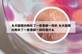 女大腿根内侧长了一些像癣一样的 女大腿根内侧长了一些像癣一样的是什么