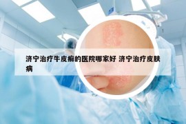 济宁治疗牛皮癣的医院哪家好 济宁治疗皮肤病