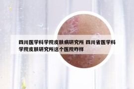 四川医学科学院皮肤病研究所 四川省医学科学院皮肤研究所这个医院咋样
