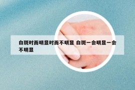 白斑时而明显时而不明显 白斑一会明显一会不明显