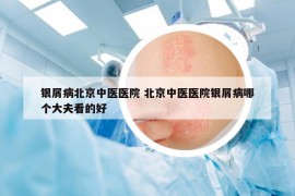 银屑病北京中医医院 北京中医医院银屑病哪个大夫看的好