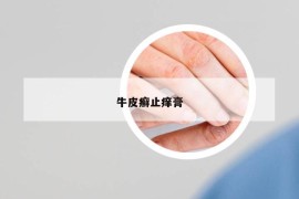 牛皮癣止痒膏