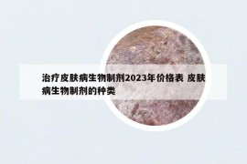 治疗皮肤病生物制剂2023年价格表 皮肤病生物制剂的种类