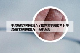 牛皮癣的生物制剂入了医保没拿到医保卡 牛皮癣打生物制剂为什么那么贵