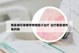 银屑病可用哪种物理因子治疗 治疗银屑病外用药物