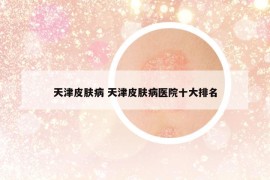 天津皮肤病 天津皮肤病医院十大排名