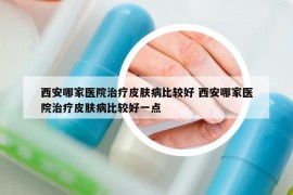 西安哪家医院治疗皮肤病比较好 西安哪家医院治疗皮肤病比较好一点