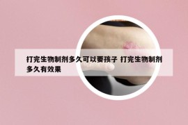打完生物制剂多久可以要孩子 打完生物制剂多久有效果
