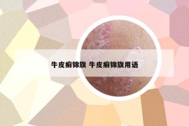 牛皮癣锦旗 牛皮癣锦旗用语