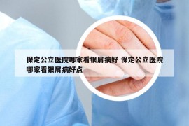 保定公立医院哪家看银屑病好 保定公立医院哪家看银屑病好点