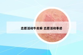 志愿活动牛皮癣 志愿活动事迹