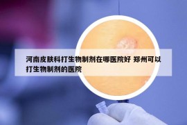 河南皮肤科打生物制剂在哪医院好 郑州可以打生物制剂的医院