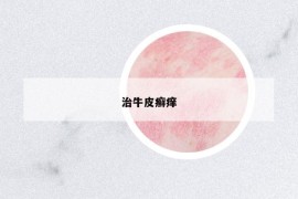治牛皮癣痒