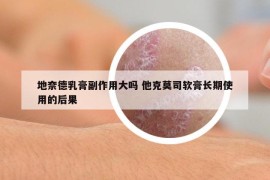 地奈德乳膏副作用大吗 他克莫司软膏长期使用的后果