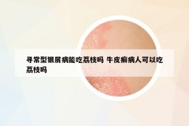 寻常型银屑病能吃荔枝吗 牛皮癣病人可以吃荔枝吗