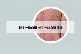 长了一块白斑 长了一块白斑很痒