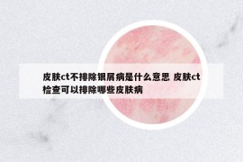 皮肤ct不排除银屑病是什么意思 皮肤ct检查可以排除哪些皮肤病