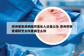 郑州银屑病病医院是私人还是公办 郑州市银屑病研究会所看病怎么样