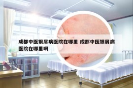 成都中医银屑病医院在哪里 成都中医银屑病医院在哪里啊
