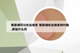 银屑病可以吃谷维素 银屑病吃谷维素和叶酸,再加什么药
