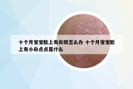 十个月宝宝脸上有白斑怎么办 十个月宝宝脸上有小白点点是什么
