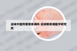 运城中医院看银屑病吗 运城银屑病医学研究院