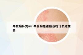 牛皮癣补充wc 牛皮癣患者应该吃什么维生素