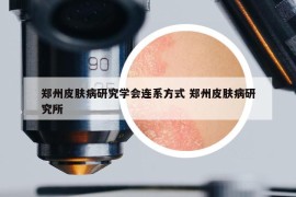 郑州皮肤病研究学会连系方式 郑州皮肤病研究所