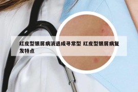 红皮型银屑病消退成寻常型 红皮型银屑病复发特点