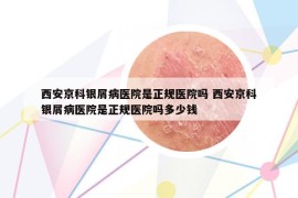 西安京科银屑病医院是正规医院吗 西安京科银屑病医院是正规医院吗多少钱