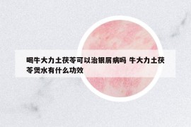 喝牛大力土茯苓可以治银屑病吗 牛大力土茯苓煲水有什么功效