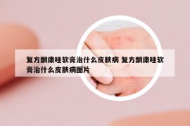 复方酮康唑软膏治什么皮肤病 复方酮康唑软膏治什么皮肤病图片