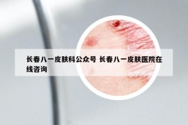 长春八一皮肤科公众号 长春八一皮肤医院在线咨询