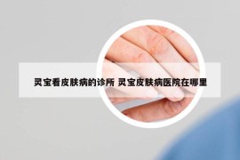 灵宝看皮肤病的诊所 灵宝皮肤病医院在哪里