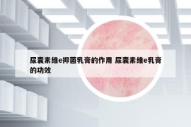 尿囊素维e抑菌乳膏的作用 尿囊素维e乳膏的功效