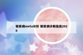 银屑病meta分析 银屑病诊断指南2020