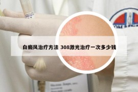 白癜风治疗方法 308激光治疗一次多少钱