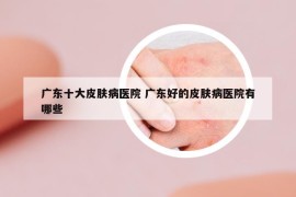 广东十大皮肤病医院 广东好的皮肤病医院有哪些