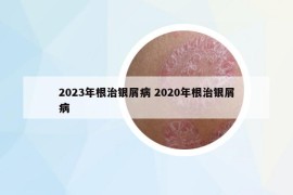 2023年根治银屑病 2020年根治银屑病