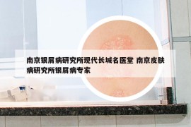 南京银屑病研究所现代长城名医堂 南京皮肤病研究所银屑病专家