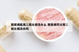 银屑病能用二硫化硒洗头么 银屑病可以用二硫化硒洗头吗