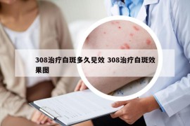 308治疗白斑多久见效 308治疗白斑效果图