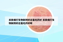 皮肤病打生物制剂好还是吃药好 皮肤病打生物制剂好还是吃药好呢