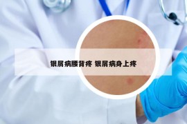 银屑病腰背疼 银屑病身上疼