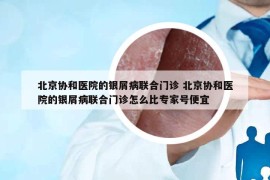 北京协和医院的银屑病联合门诊 北京协和医院的银屑病联合门诊怎么比专家号便宜